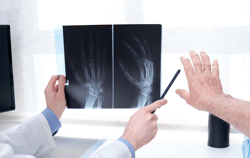 artikulazio artrosiaren diagnostikoa