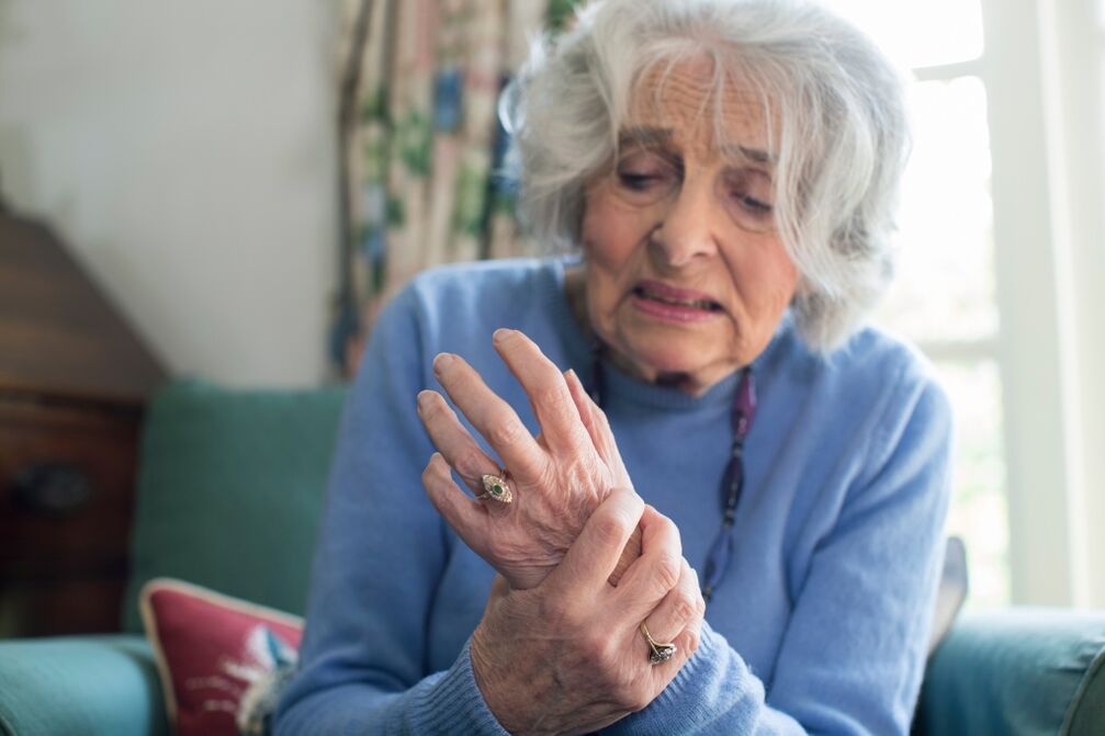 adineko emakume baten eskuetako artikulazioen artrosia